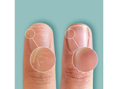 CND Rescuerxx nail cure pen