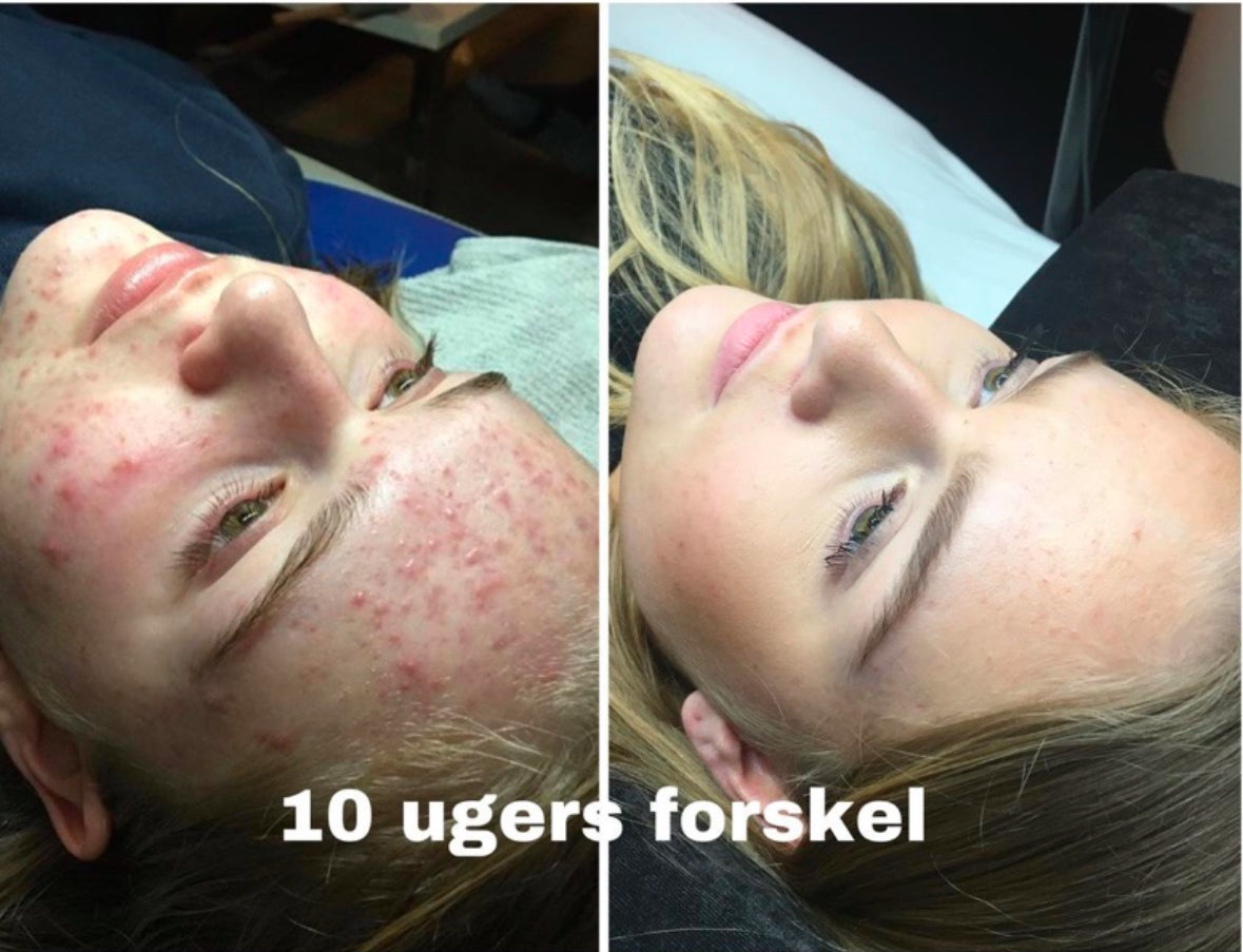 Rosalique 3 i 1-antirødmecreme SPF 50